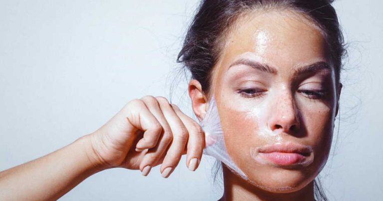 face peeling after sun
